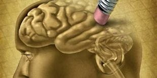 За больными Альцгеймером