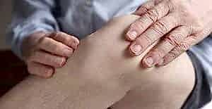 артроз коленного сустава