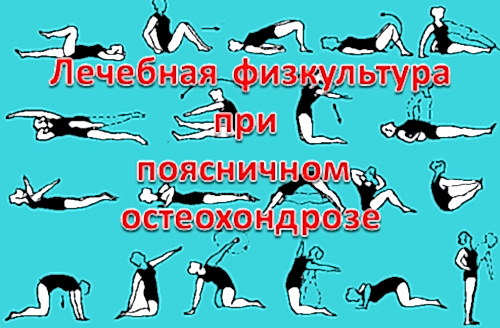 лечебная физкультура при остеохондрозе