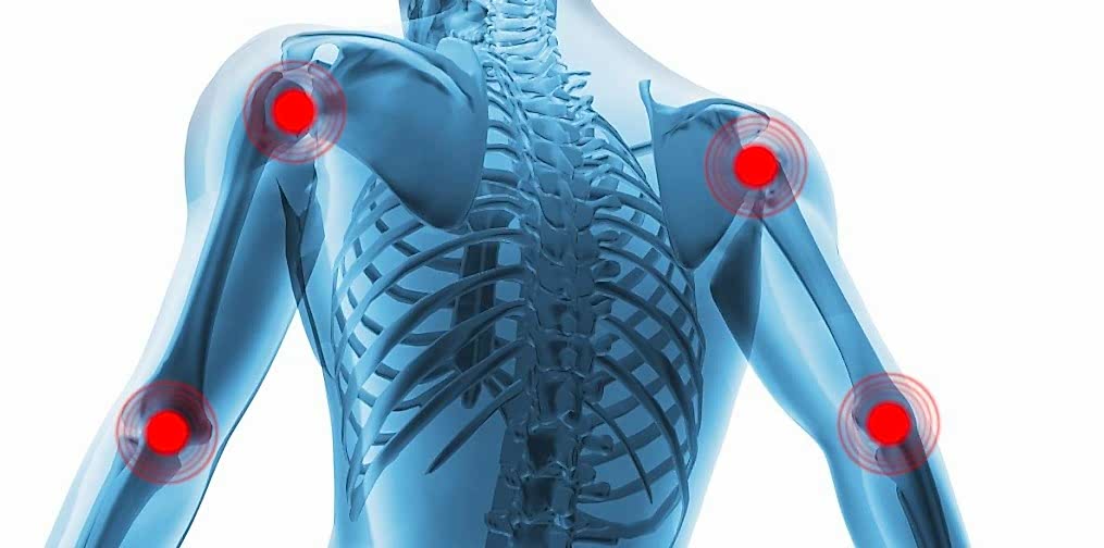 заболевания опорно-двигательного аппарата