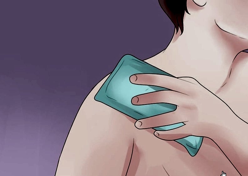 перелом ключицы