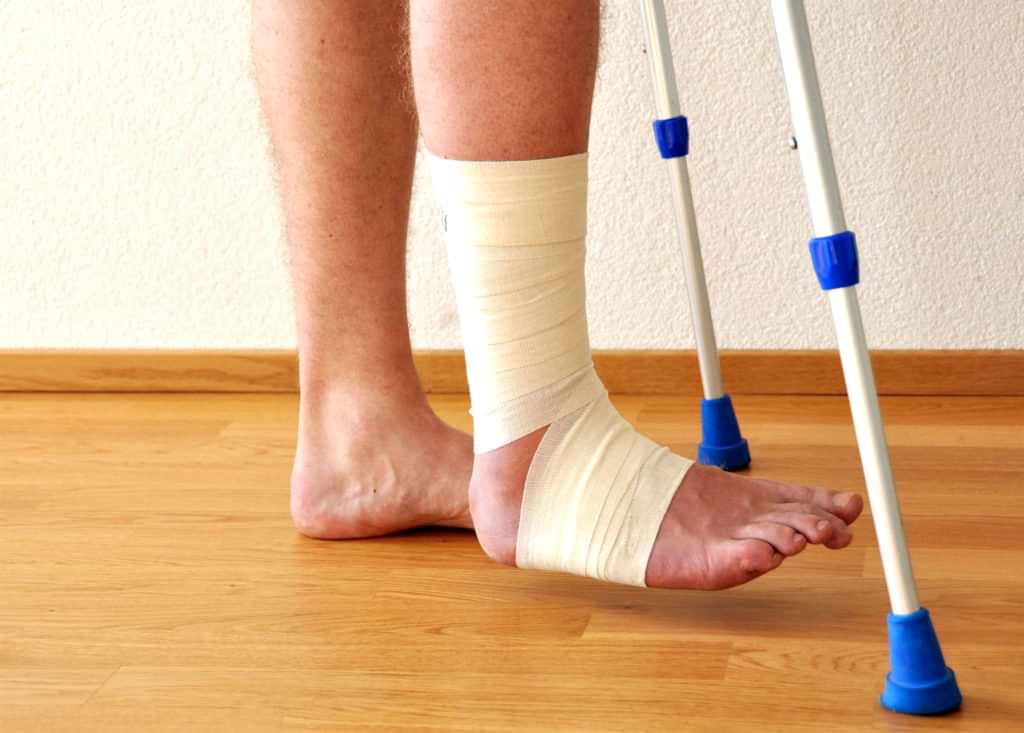 после перелома лодыжки