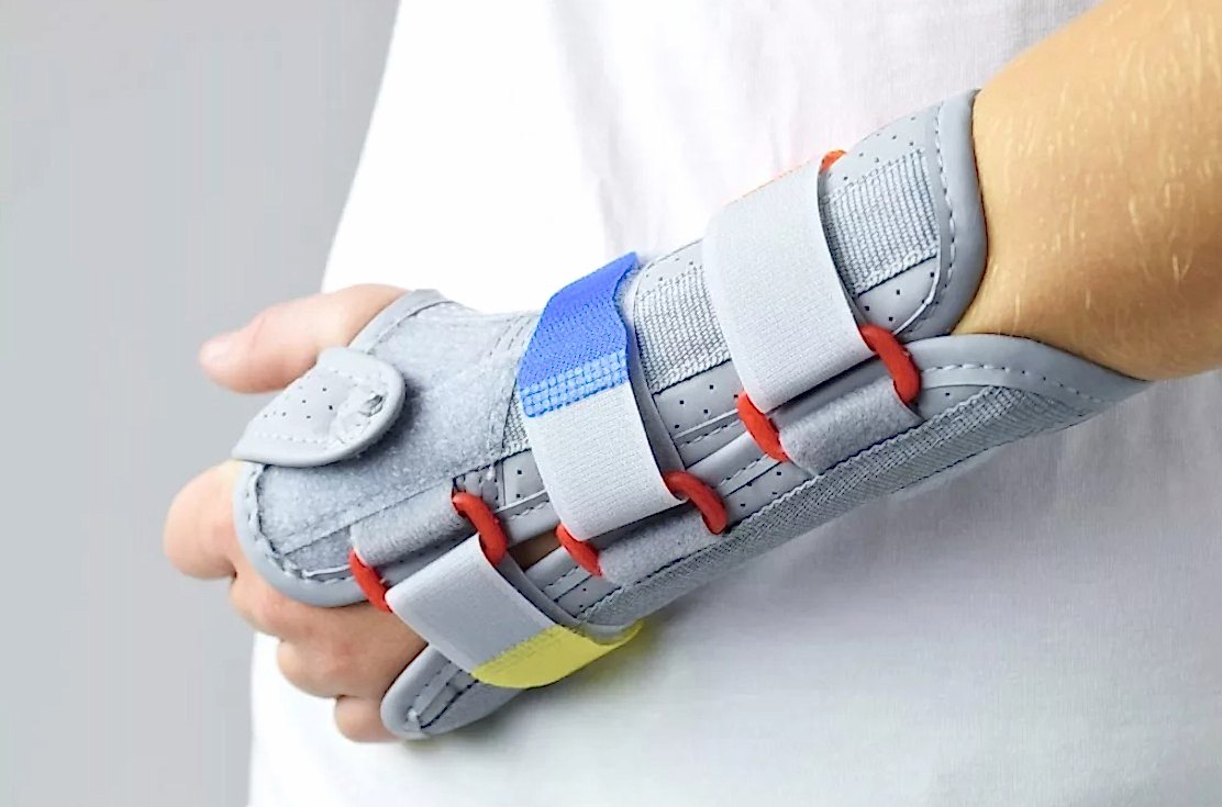 восстановление при переломе кисти